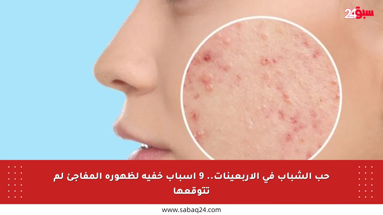 حب الشباب في الأربعينات.. 9 أسباب خفية لظهوره المفاجئ لم تتوقعها